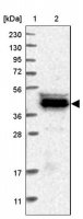 Anti-CARNMT1 antibody produced in rabbit