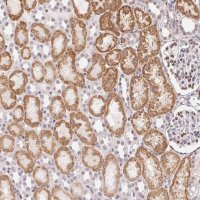 Anti-CASC10 antibody produced in rabbit 