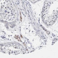 Anti-CATSPERD antibody produced in rabbit 