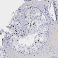 Anti-CBX2 antibody produced in rabbit 