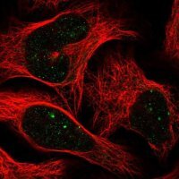 Anti-CBX4 antibody produced in rabbit 