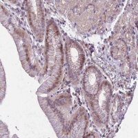 Anti-CBX6 antibody produced in rabbit 