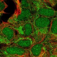 Anti-CBX6 antibody produced in rabbit 