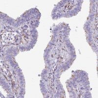 Anti-CC2D2A antibody produced in rabbit 