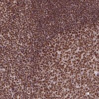Anti-CCAR1 antibody produced in rabbit 