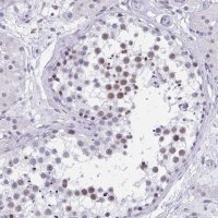 Anti-CCDC105 antibody produced in rabbit 