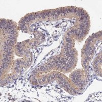Anti-CCDC113 antibody produced in rabbit HPA040759-100UL