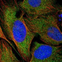 Anti-CCDC121 antibody produced in rabbit