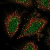 Anti-CCDC122 antibody produced in rabbit 