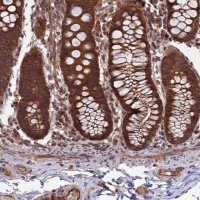 Anti-CCDC125 antibody produced in rabbit 