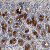 Anti-CCDC126 antibody produced in rabbit 