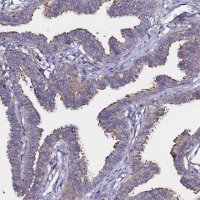 Anti-CCDC13 antibody produced in rabbit 