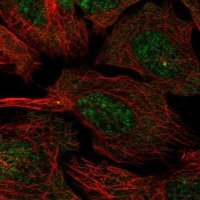 Anti-CCDC13 antibody produced in rabbit 