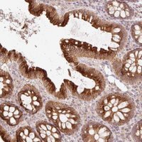 Anti-CCDC130 antibody produced in rabbit 