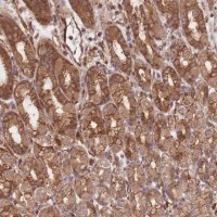 Anti-CCDC140 antibody produced in rabbit 
