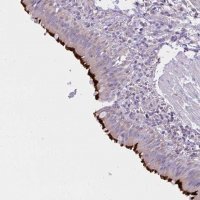 Anti-CCDC142 antibody produced in rabbit 