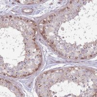 Anti-CCDC150 antibody produced in rabbit 