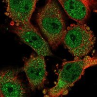 Anti-CCDC159 antibody produced in rabbit 