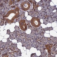 Anti-CCDC160 antibody produced in rabbit 