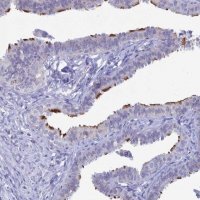 Anti-CCDC173 antibody produced in rabbit 