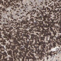Anti-CCDC175 antibody produced in rabbit 
