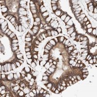 Anti-CCDC18 antibody produced in rabbit 