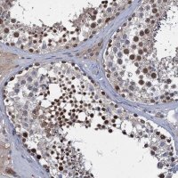 Anti-CCDC184 antibody produced in rabbit 
