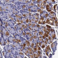 Anti-CCDC22 antibody produced in rabbit 