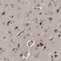 Anti-CCDC25 antibody produced in rabbit HPA023256-100UL