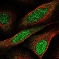 Anti-CCDC3 antibody produced in rabbit 