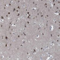 Anti-CCDC34 antibody produced in rabbit 