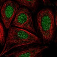 Anti-CCDC61 antibody produced in rabbit 