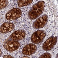 Anti-CCDC66 antibody produced in rabbit 