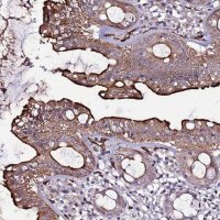 Anti-CCDC71 antibody produced in rabbit 