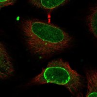 Anti-CCDC71 antibody produced in rabbit 