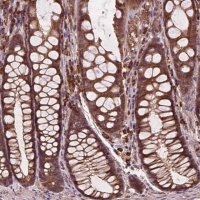 Anti-CCDC71L antibody produced in rabbit