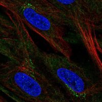 Anti-CCDC71L antibody produced in rabbit