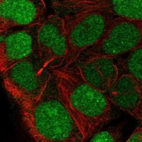 Anti-CCDC84 antibody produced in rabbit 