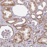 Anti-CCDC85B antibody produced in rabbit 