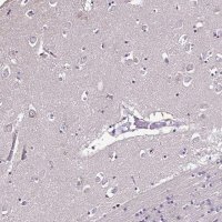 Anti-CCDC85C antibody produced in rabbit 