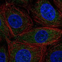 Anti-CCDC9 antibody produced in rabbit 