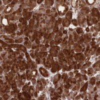 Anti-CCDC91 antibody produced in rabbit 