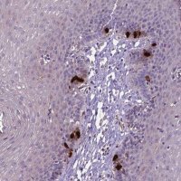 Anti-CCER2 antibody produced in rabbit 