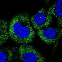 Anti-CCHCR1 antibody produced in rabbit 