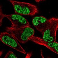 Anti-CCM2L antibody produced in rabbit 