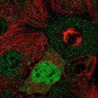 Anti-CCND2 antibody produced in rabbit 