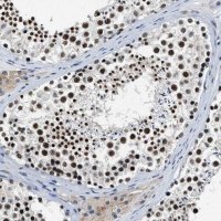 Anti-CCNE1 antibody produced in rabbit