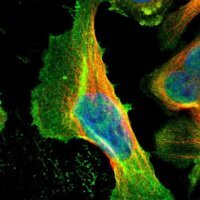 Anti-CCNT2 antibody produced in rabbit