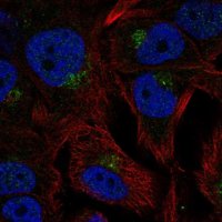Anti-CCPG1 antibody produced in rabbit 