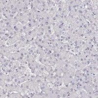 Anti-CCR8 antibody produced in rabbit 